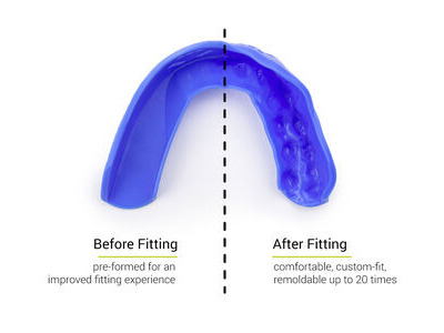 Sisu 3D Mouth Guard click to zoom image
